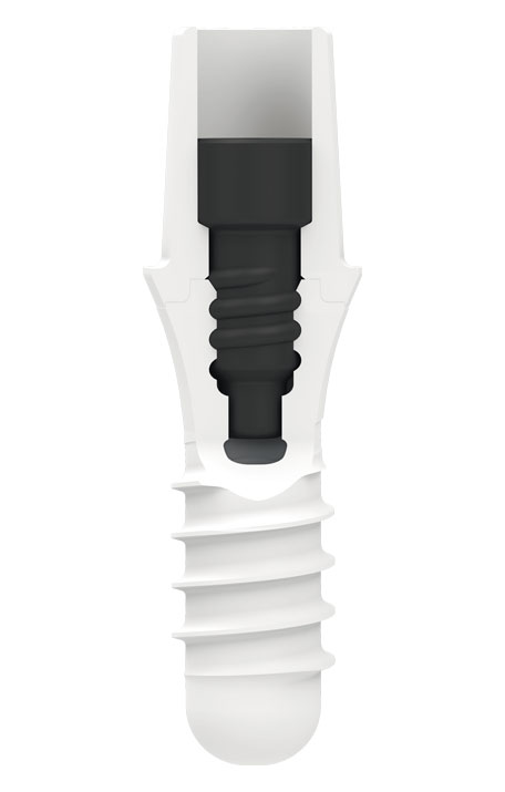 Systembild ZERAMEX® P6 Implantat mit VICARBO® Schraube in der Schnittansicht
