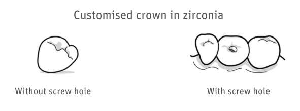 Zeramex Digital Solutions - Crowns
