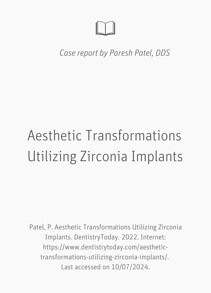Ästhetische Transformationen mit Hilfe von Zirkoniumdioxid-Implantaten Zeramex XT Ästhetische Transformationen mit Hilfe von Zirkoniumdioxid-Implantaten Zeramex XT