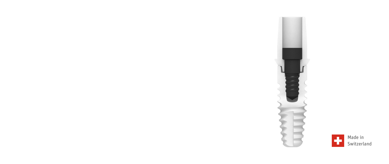 Impianto in ceramica