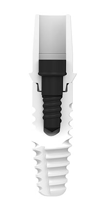 zeramex_implantatsystem_xt_verbindung_implantat_schnitt_206x413px Systembild ZERAMEX® XT Implantat in der Schnittansicht mit VICARBO® Schraube