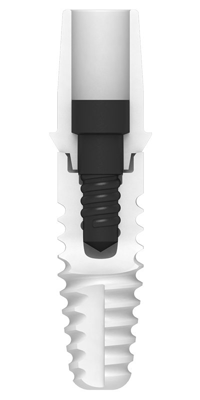 Zirkonoxid-Implantate Zeramex XT mit Vicarbo Schraube