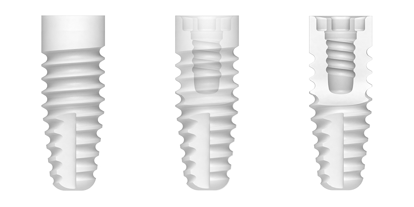 Zirconia implants Zeramex XT – ZERAMEX CeramTec Schweiz GmbH