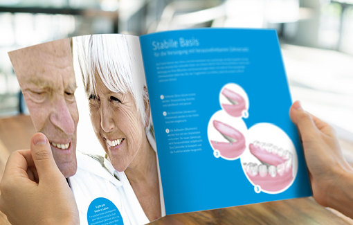 Dental implants