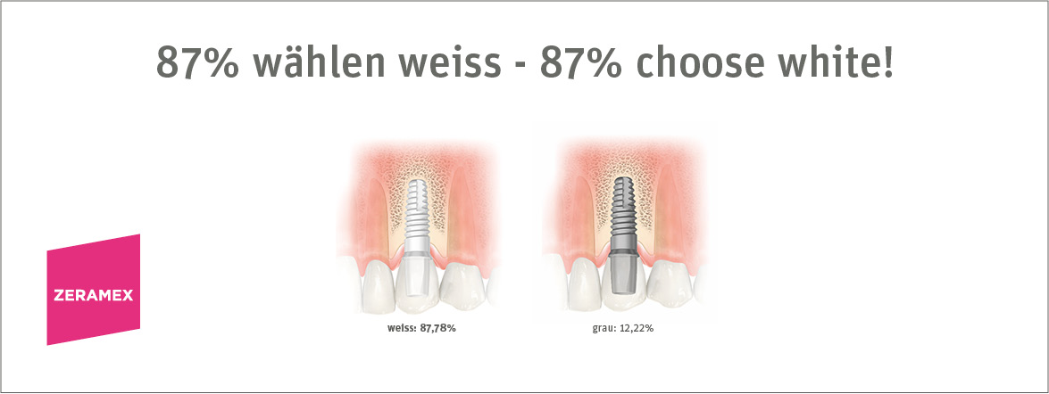 1000er Challenge Konsumentenumfrage